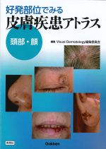 好発部位でみる皮膚疾患アトラス　頭部・顔の書影