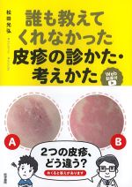 誰も教えてくれなかった 皮疹の診かた・考えかた　Web動画付の書影