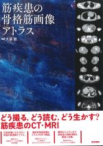 筋疾患の骨格筋画像アトラスの書影