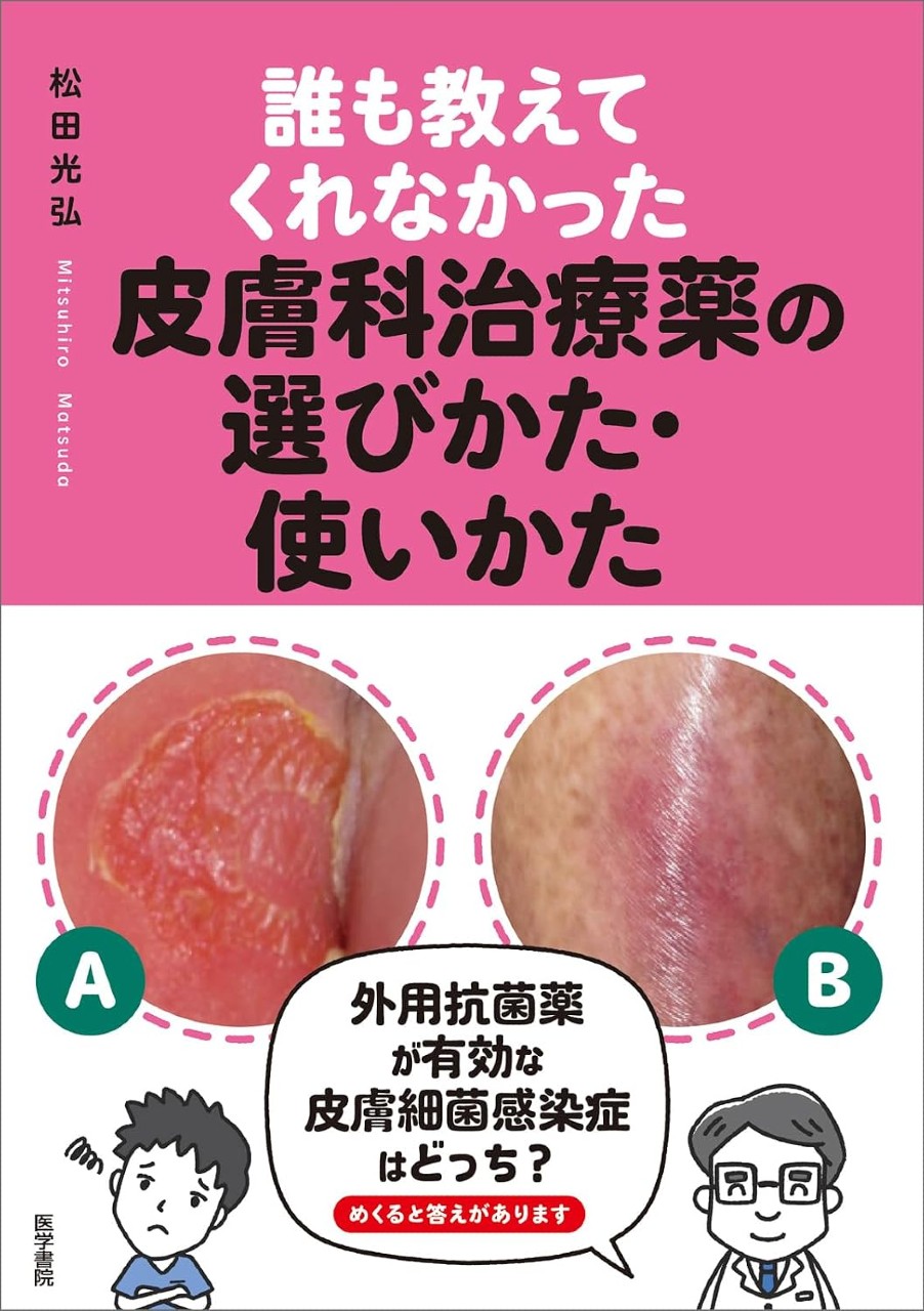 【8月10日頃発売予定】
誰も教えてくれなかった皮膚科治療薬の選びかた・使いかたの書影