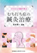 イラストと写真で学ぶ むち打ち症の鍼灸治療の書影