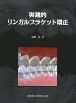実践的リンガルブラケット矯正の書影