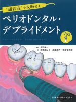 “超音波”を攻略せよ ペリオドンタル・デブライドメント　プラス1の書影