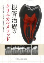 根管治療のクリニカルメソッドの書影