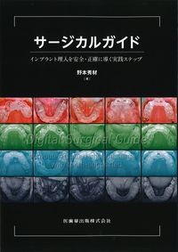 サージカルガイド：インプラント埋入を安全・正確に導く実践ステップの書影