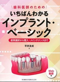 歯科医師のためのいちばんわかるインプラント・ベーシック：症例選択から埋入・メインテナンスまで　Web動画付の書影