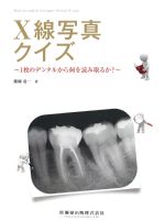 X線写真クイズ：１枚のデンタルから何を読み取るか？の書影