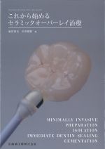これから始めるセラミックオーバーレイ治療の書影