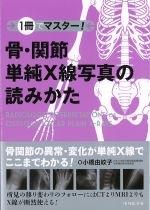 １冊でマスター！ 骨・関節単純X線写真の読みかたの書影
