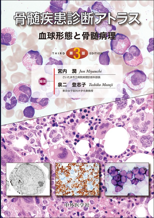 骨髄疾患診断アトラス:血球形態と骨髄病理 第3版の書影