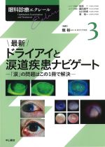 (眼科診療エクレール 3)最新ドライアイと涙道疾患ナビゲート：「涙」の問題はこの１冊で解決の書影