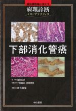 癌治療戦略に活かす病理診断ベストプラクティス　下部消化管癌の書影