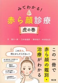 みてわかる！赤ら顔診療：虎の巻の書影