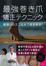 最強巻き爪矯正テクニック：基礎からスゴ技まで徹底解説！の書影