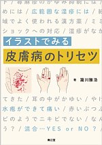イラストでみる皮膚病のトリセツの書影