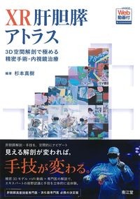 XR肝胆膵アトラス：3D空間解剖で極める精密手術・内視鏡治療の書影
