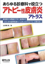 あらゆる診療科で役立つアトピー性皮膚炎アトラスの書影