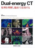 Dual-energy CT：原理を理解し臨床で活用するの書影