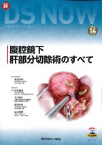 (新DS NOW 14)腹腔鏡下肝部分切除術のすべての書影