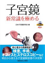 子宮鏡：新常識を極めるの書影