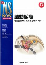 (新NS NOW 17)脳動脈瘤：専門医になるための基本ポイントの書影