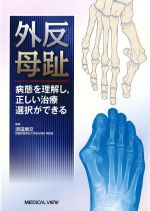 外反母趾：病態を理解し、正しい治療選択ができるの書影