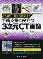 どう撮り、何を作成する？ 手術支援に役立つ３次元CT画像の書影