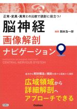 正常・変異・異常との比較で読影に役立つ！ 脳神経画像解剖ナビゲーションの書影