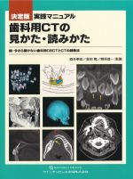 決定版 実践マニュアル歯科用CTの見かた・読みかた：続・今さら聞けない歯科用CBCTとCTの読像法の書影