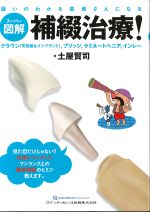 スーパー図解補綴治療！：クラウン(天然歯＆インプラント)、ブリッジ、ラミネートベニア、インレーの書影