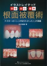 イラストレイテッド 安心・安全・確実　根面被覆術：ドクターの「ここが知りたかった！」が満載の書影