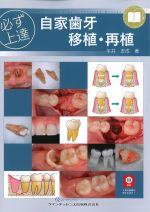 必ず上達自家歯牙移植・再植の書影