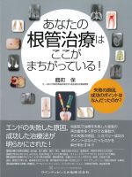 あなたの根管治療はここがまちがっている！の書影