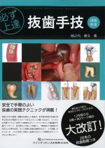 必ず上達 抜歯手技　増補新版の書影