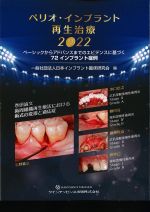 ペリオ・インプラント再生治療 2022：ベーシックからアドバンスまでのエビデンスに基づく72インプラント症例の書影