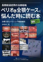 長期経過症例の治療戦略　ペリオ＆全顎ケースに悩んだ時に読む本：治療方針とテクニック徹底解説の書影