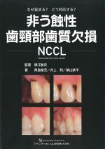 なぜ起きる？ どう対応する？ 非う蝕性歯頸部歯質欠損NCCLの書影