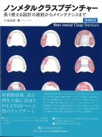 ノンメタルクラスプデンチャー：長く使える設計の原則からメインテナンスまで　増補新版の書影