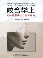 咬合挙上：その意思決定と臨床手技の書影