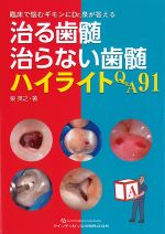 臨床で悩むギモンにDr.泉が答える 治る歯髄治らない歯髄ハイライトQ＆A91の書影