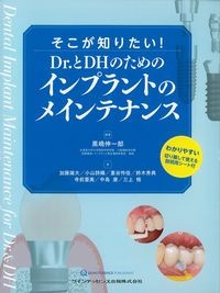 そこが知りたい！Dr.とDHのためのインプラントのメインテナンスの書影