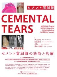 セメント質剥離CEMENTAL TEARSの書影