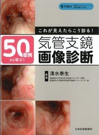 50症例から学ぶ！これが見えたらこう診る！気管支鏡画像診断の書影