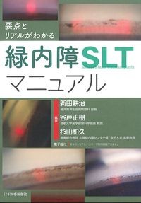 要点とリアルがわかる
緑内障SLTマニュアルの書影