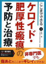 ここまでできるケロイド・肥厚性瘢痕の予防と治療の書影