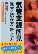 気管支鏡所見 見方・読み方・考え方の書影