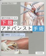 整形外科医のための下肢のアドバンスト手術の書影