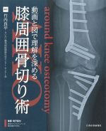 動画と図で理解を深める膝周囲骨切り術の書影