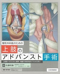 整形外科医のための上肢のアドバンスト手術：上級医になるために標準～発展の手術手技をプロから学ぶの書影
