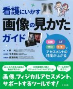 看護にいかす画像の見かたガイド：X線・CT・MRI・エコーでアセスメントの精度が上がるの書影
